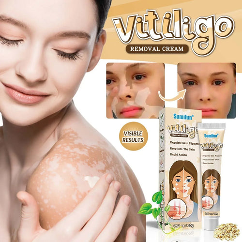 Crema Sumifun Vitiligo 20G